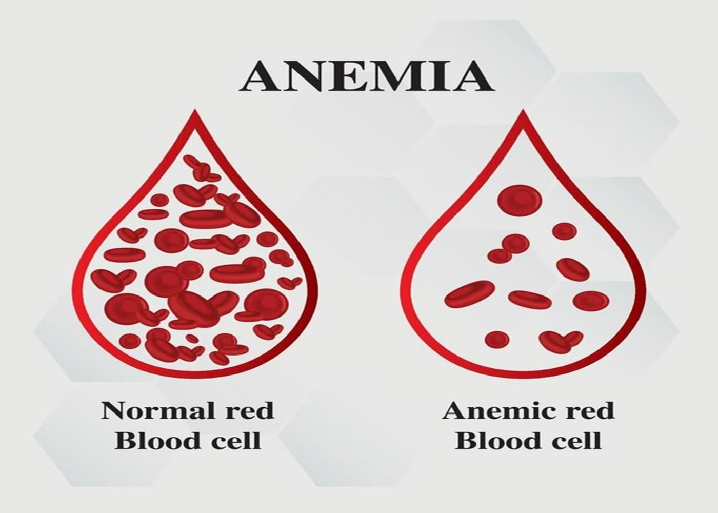 Pediatric Anemia Treatment